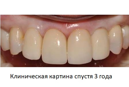 12.jpg 12.jpg